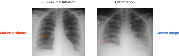Submaximal vs. full inflation