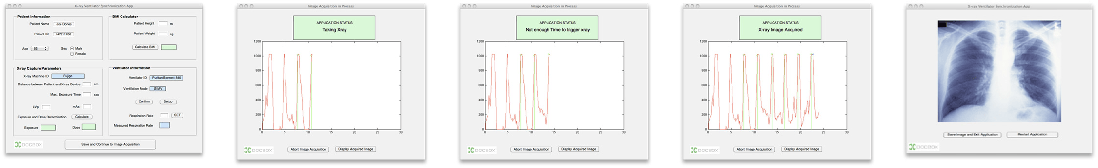 MATLAB application to prototype workflow